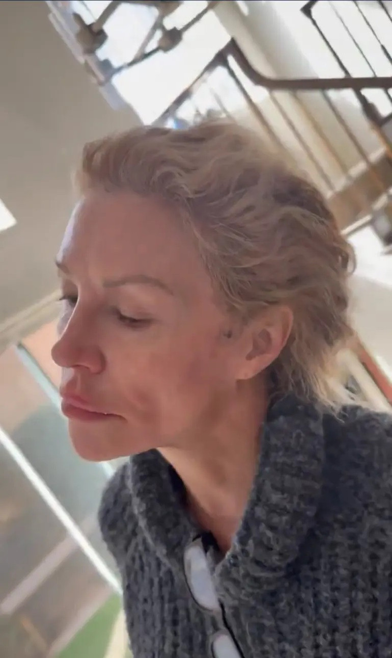  Bir gecede 20 yıl yaşlandım