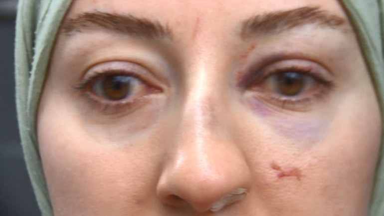 Sen misin o anları kayda alan Evinin önündeki olayı görüntüleyen kadını feci şekilde darbettiler