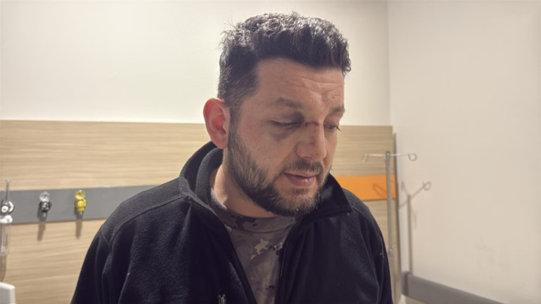 Türkiyeyi ayağa kaldıran olayda serbest kalan komşu konuştu: Çocuğun gözünün morarmasını buna bağladı