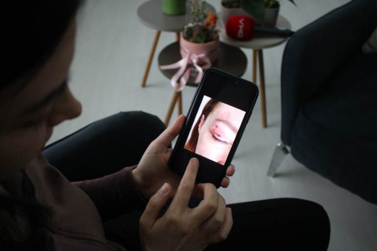 Güzellik salonundaki 1.100 TLlik işlem genç kadının kabusu oldu: Şikayeti reddedildi | Çevremdekiler fark etti