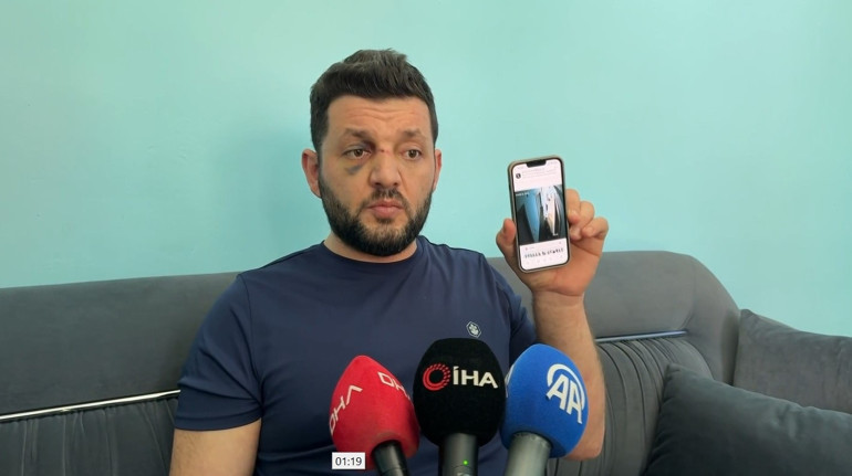 14 aylık bebek ve babası komşuları tarafından darbedilmişti: Güvenlik kamerası görüntüleri ortaya çıktı