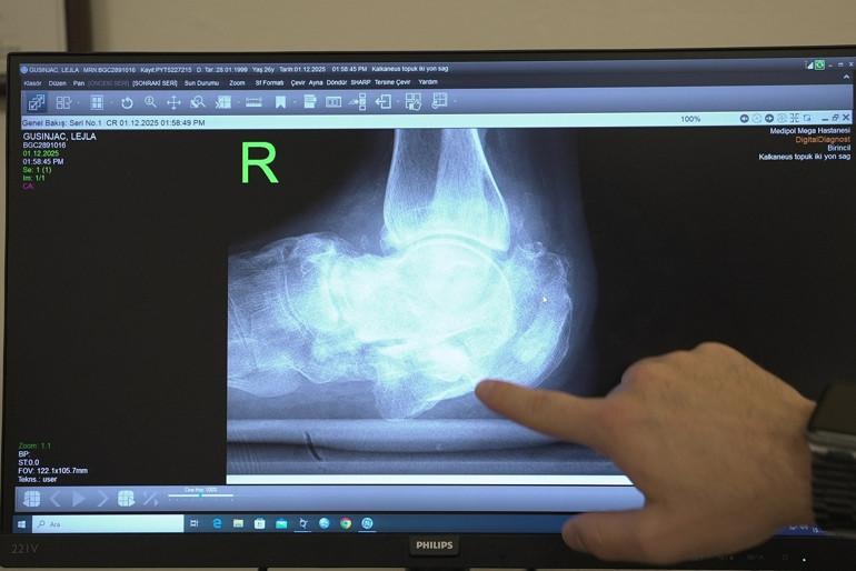 Ülkesinde ayağının kesileceğini söylediler, Türkiyede sağlığına kavuştu