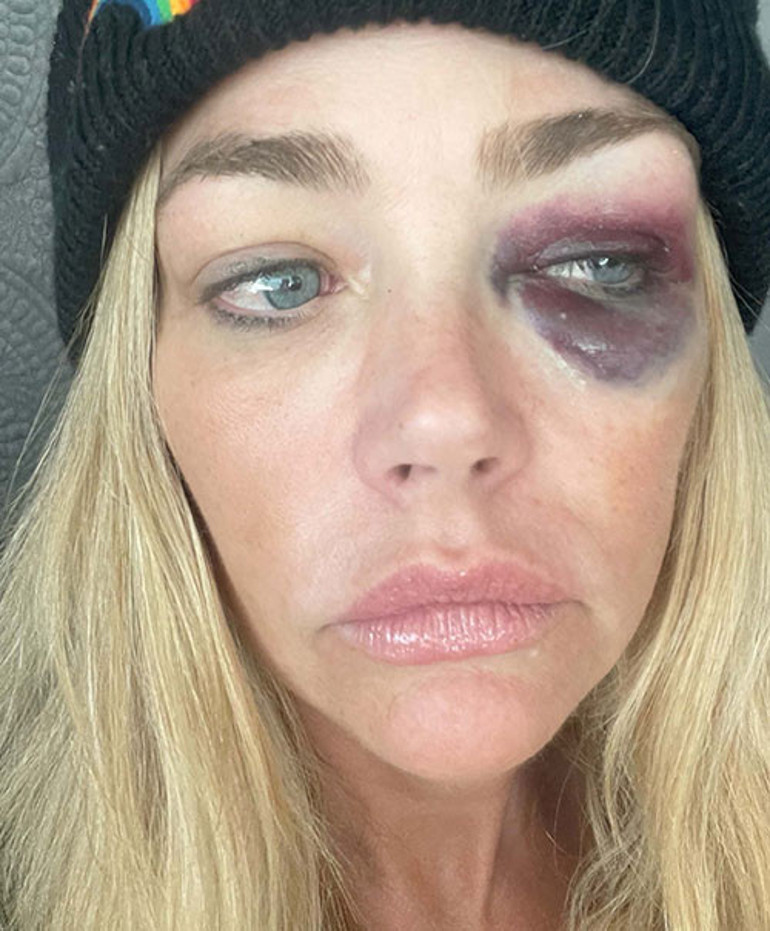 Yedi yıllık evliliği bitti, neyi varsa elinden gitti... Yılların kazancını ayrıldığı kocasına kaptırdı