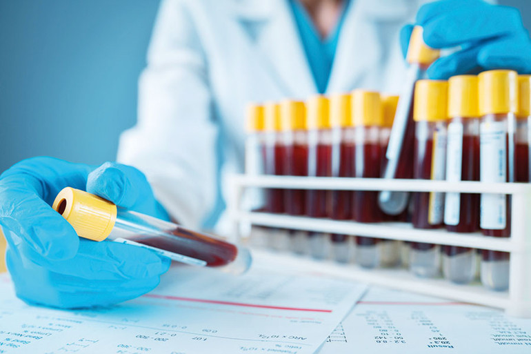 Erkeklerde sessiz düşüş