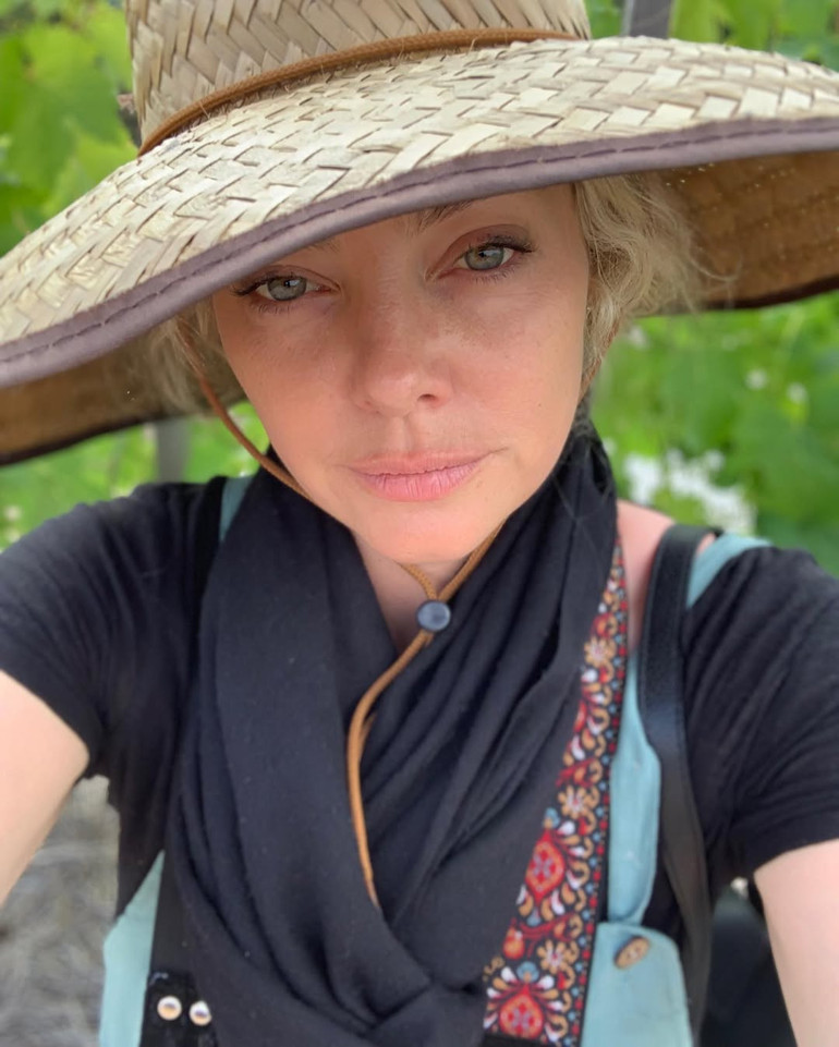  Böbrek nakli olmazsam kısa zaman sonra öleceğim