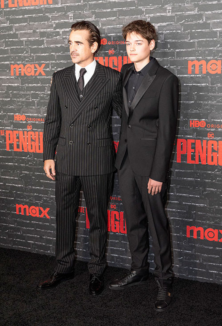 Ünlü oyuncunun oğlu çaresiz bir hastalıkla doğdu: Ona Zavallı şey dediler... İçim burkuldu, o hepimizden daha mutlu