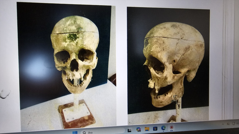 Zonguldakta Kirpi Ahmet cinayeti 18 yıl sonra çözüldü Boğarak öldürüp çuvalla kaçak ocağa sonra baraja atmışlar