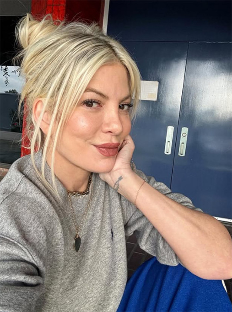  Boşanınca bile içi böyle yanmamıştı.,. Güzellik için ne acılar çekti