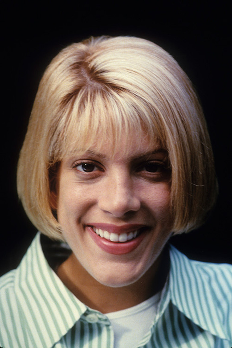  Boşanınca bile içi böyle yanmamıştı.,. Güzellik için ne acılar çekti