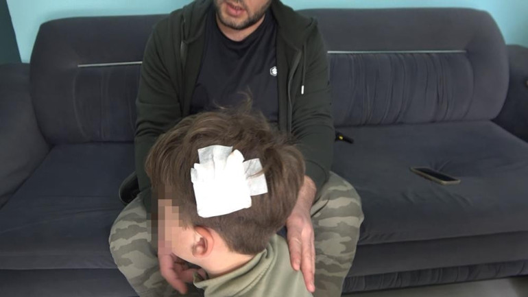  Bu kez de oğlu yaralandı Tehditler alıyoruz, evimi satışa çıkardım