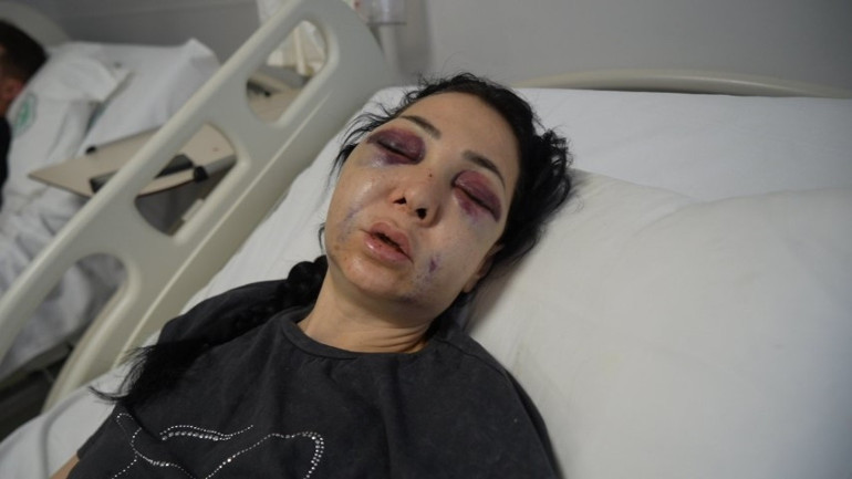 Bir uyarı yüzünden vahşet Anneye feci dayak... Oğlumun gözü önünde bana bunu yaptılar