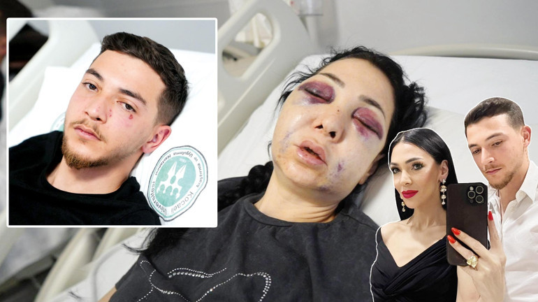 Küfretmeyin diyen anne ve oğlu öldüresiye darp edildi... Şehir eşkıyaları ne ceza alacak