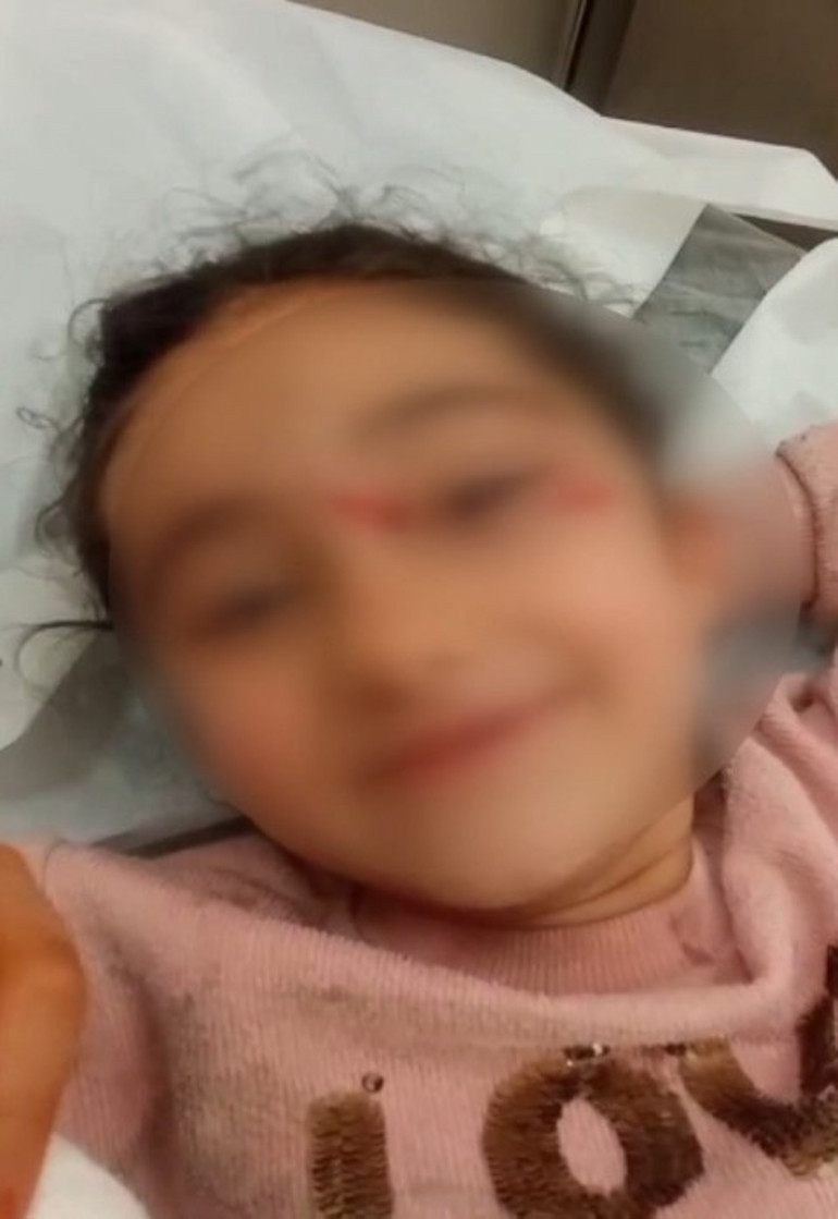 İstanbulda 6 yaşındaki çocuğa sokak köpekleri saldırdı