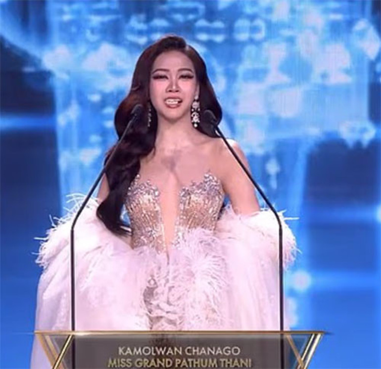  Sahnede konuşurken takma dişleri ağzından düştü