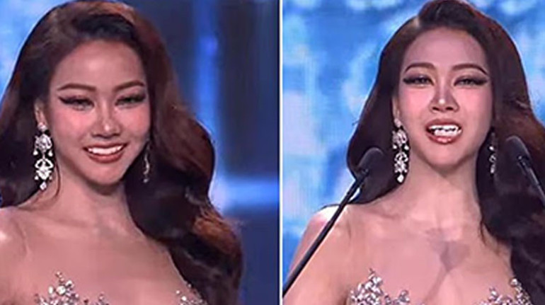  Sahnede konuşurken takma dişleri ağzından düştü