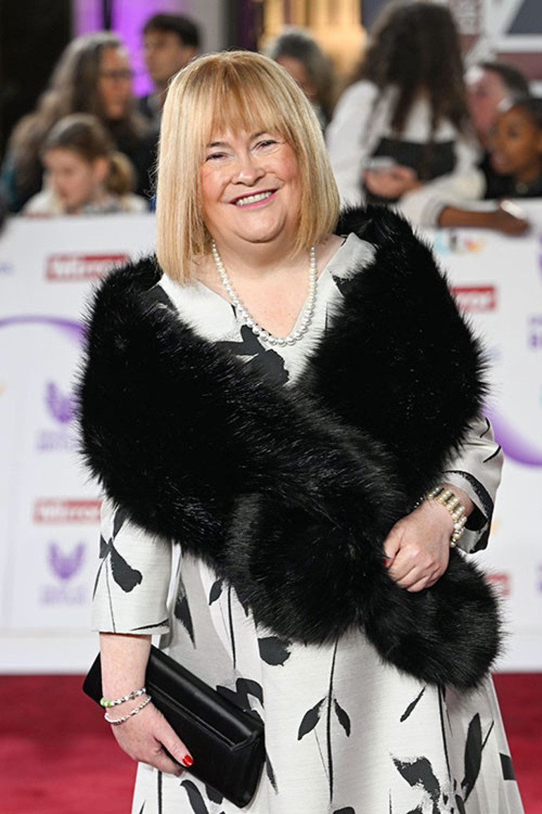  Bugün görseniz tanıyamazsınız