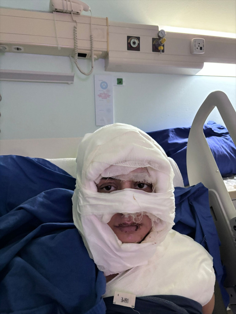  Saçlarını yakma isteği doğdu