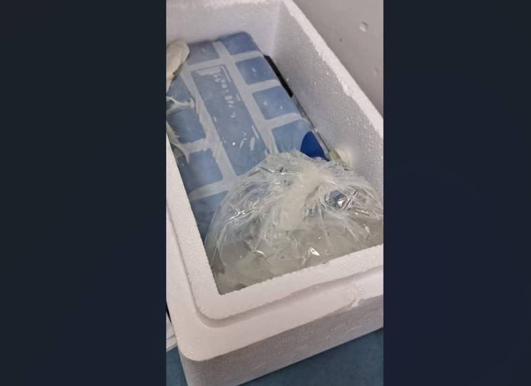  Köpeğin saldırısında koptu, doktorlar yerine dikemedi