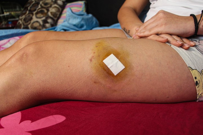  Can güvenliğim yok | Çocuklarının gözü önünde kurşun yağdırdı