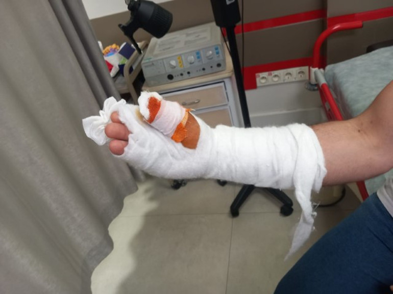  Parmağı alındı, işinden oldu | Elinden koluna doğru ilerlemiş