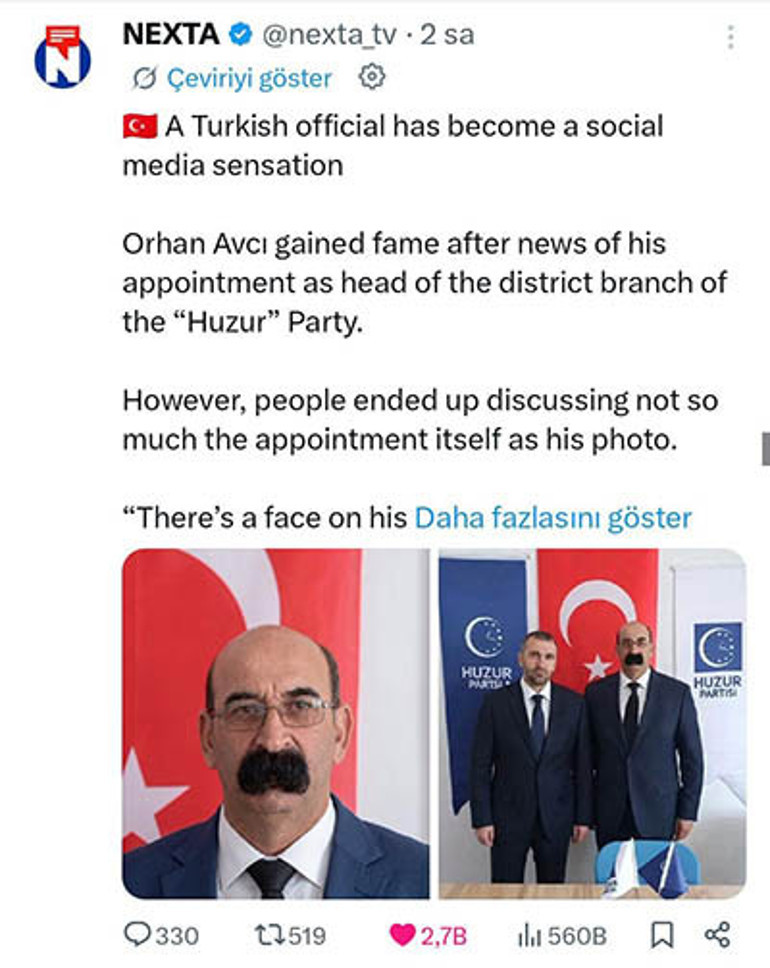  Bıyıklarımı çekemeyen, kıskanan da var