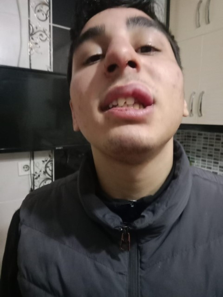 16 yaşındaki çocuğa kabusu yaşattı: Camiden evine kadar döverek götürdü | Psikolojik ilaçlar kullanmaya başladım