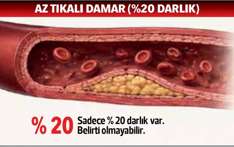 Kalbimiz ‘yanıyor’