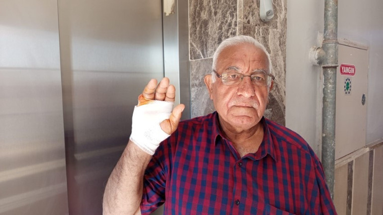 Asansördeki sorudan sonra saldırdı: Gözü dönmüş adam komşusunun parmağını ısırıp kopardı
