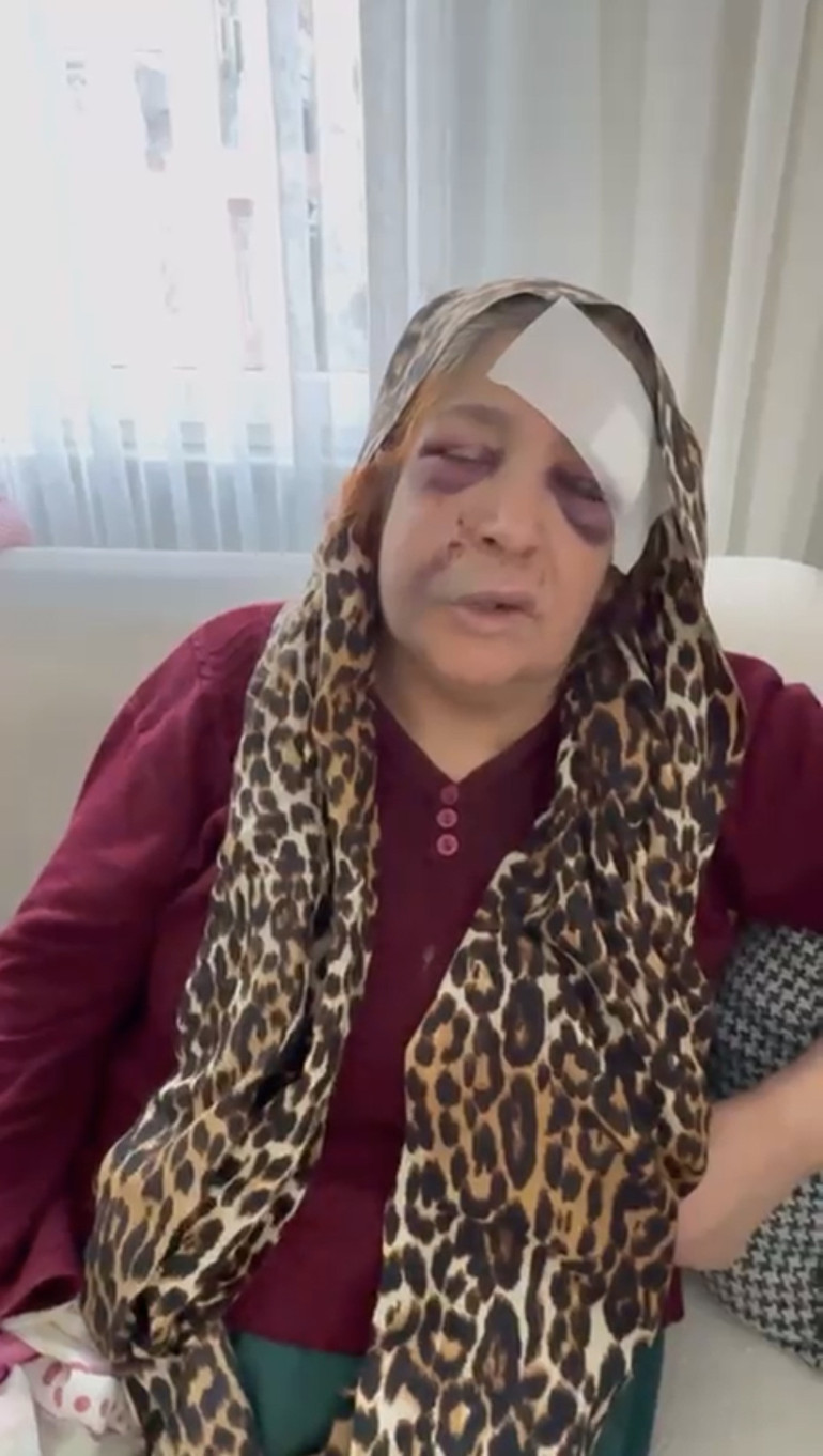 Kızını silahla vuran damadını öldürmüştü Mahalleli böyle karşıladı... Ben çocuklarımı korudum