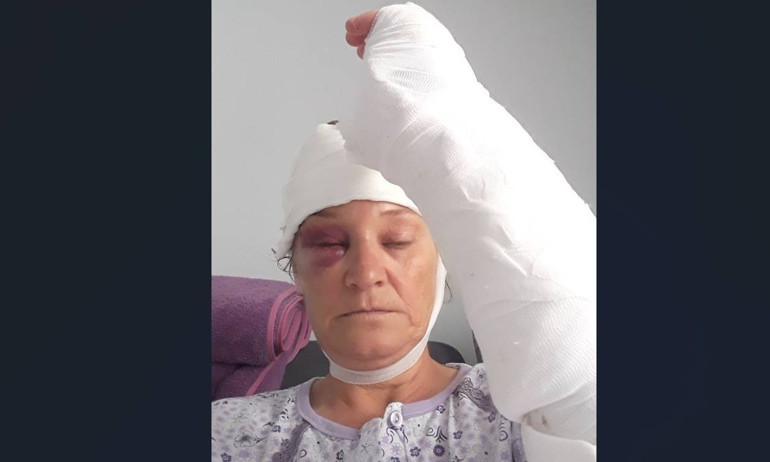 Patronun yakın koruması olan kadın kabusu yaşadı Görev tanımında olmamasına rağmen yapıyordu... Çevredekiler köpeği oyalayarak kurtardı