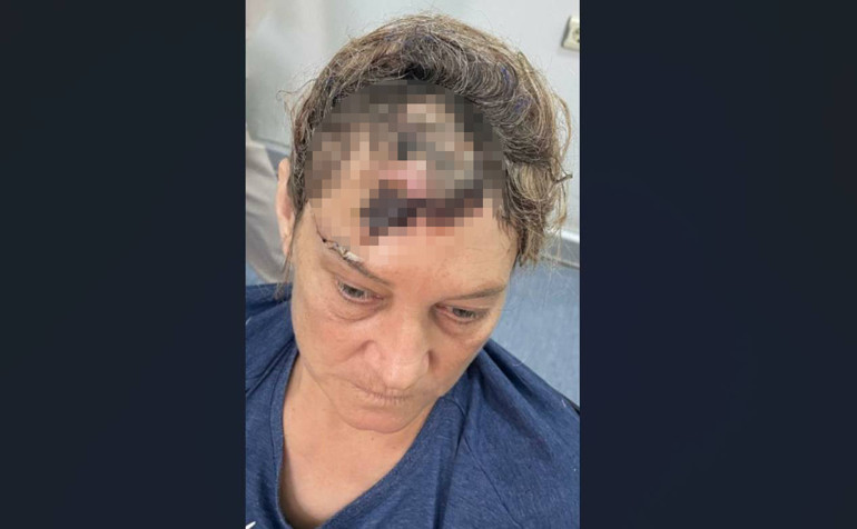 Patronun yakın koruması olan kadın kabusu yaşadı Görev tanımında olmamasına rağmen yapıyordu... Çevredekiler köpeği oyalayarak kurtardı