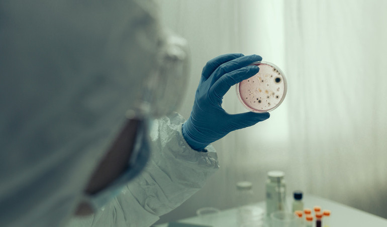 Ebola virüsü alarmı büyüyor