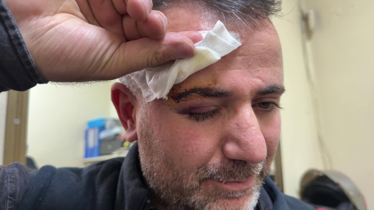 Yıkanıp tahriş olduğunu iddia ettiler: Fırıncıya saldırı kamerada