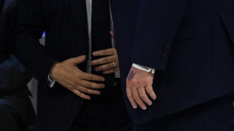 Trumpın sağlık raporu açıklandı: Kalp yaşı detayı dikkat çekti