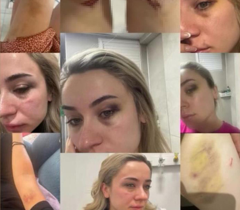  Artık sesimi çıkarmanın vakti geldi | Eski eşi tekme tokat dövdüler