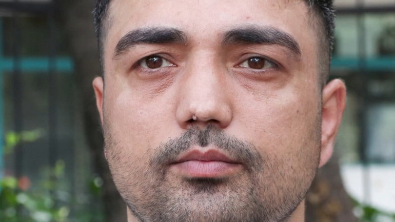 Horlama için girdiği ameliyatlar kabusa döndü 4 operasyon geçirdi, çözüm bulamadı
