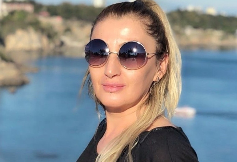 Antalyada estetik kabusu Dudağını kaybeden kadının 7 yıllık hukuk mücadelesi sürüyor