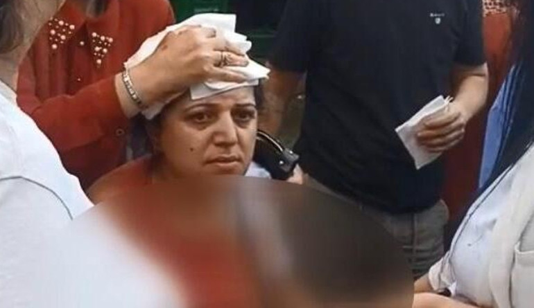 Kadın müşterinin kafasına kalas fırlatan esnaf tutuklandı
