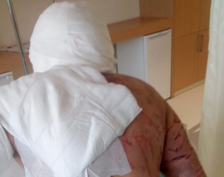 Yargıtaydan köpek saldırısı kararı: Malul kalan kadına 637 bin lira tazminat