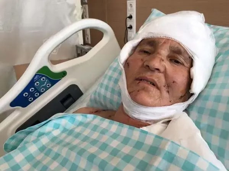 Yargıtaydan köpek saldırısı kararı: Malul kalan kadına 637 bin lira tazminat
