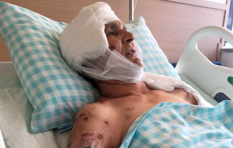 Yargıtaydan köpek saldırısı kararı: Malul kalan kadına 637 bin lira tazminat