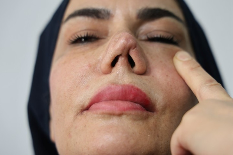 Doktoruna dava açtı