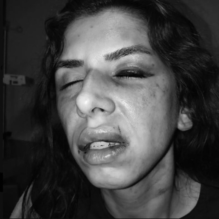 Eşini darbeden koca tutuklandı