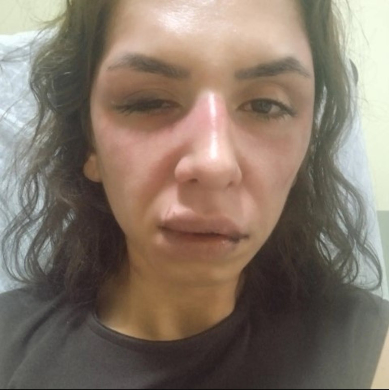 Eşini darbeden koca tutuklandı
