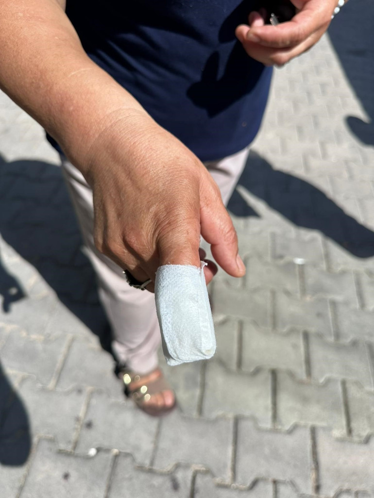  Köpeğini korumak isterken parmağından oldu