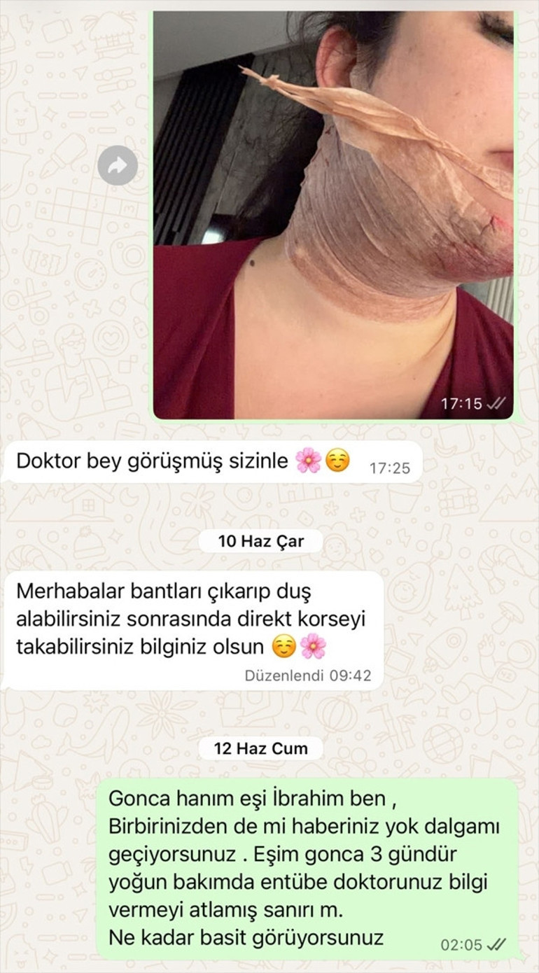 Estetik işlem sonrası kabusu yaşadı Bu benim tamamen hayatla yaşam mücadelem oldu