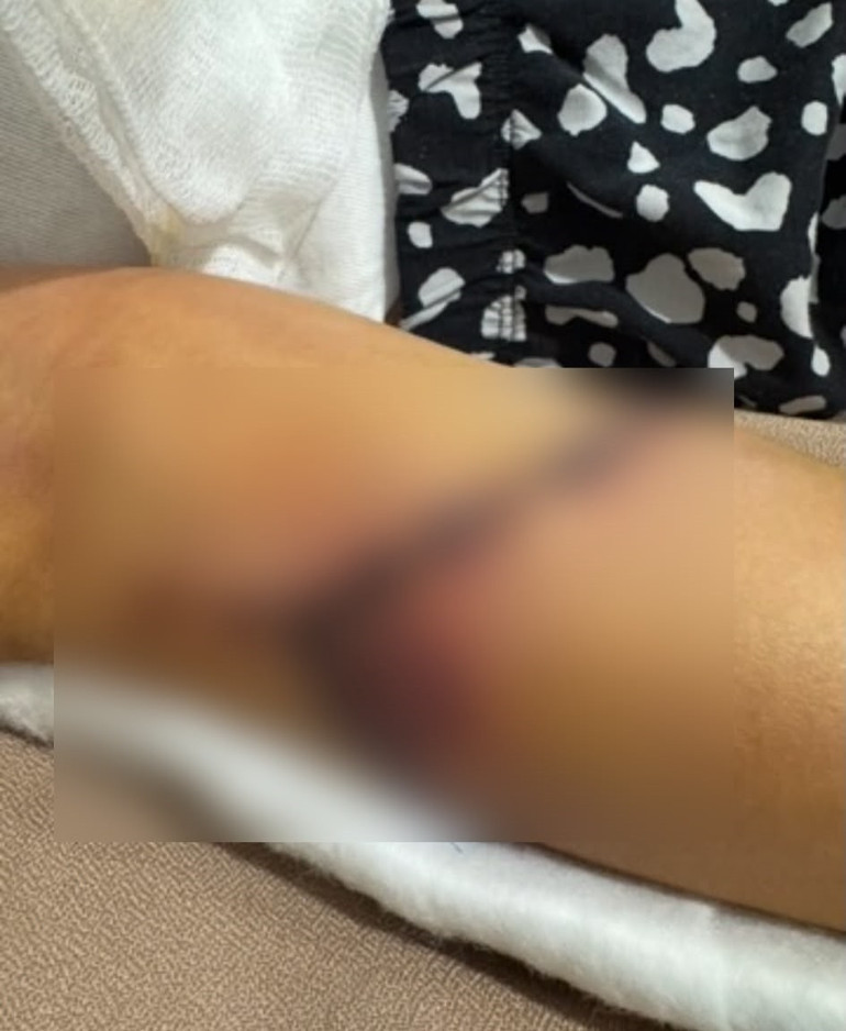 Teneffüste dehşet: Kapı kolu atardamarlarını kesen öğrenci ölümden döndü, aileden suç duyurusu