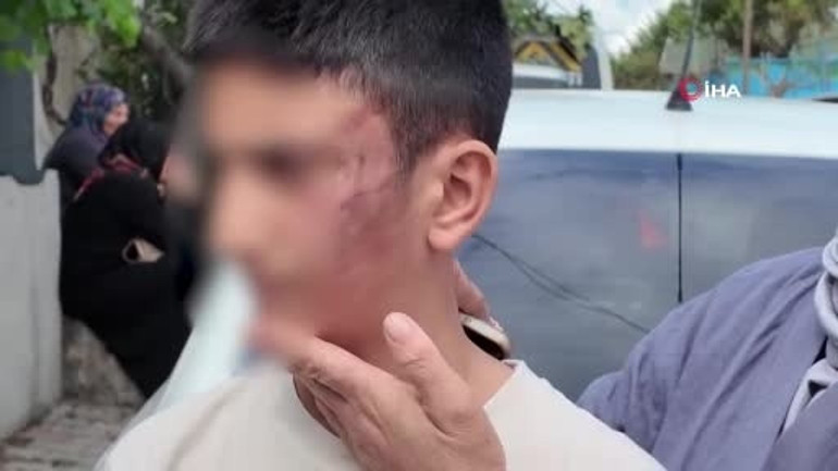 Hastalığım var diye yalvardı, dinletemedi İstanbulda epilepsi hastası çocuğa akran zulmü: Çayırlık alanda kabusu yaşattılar