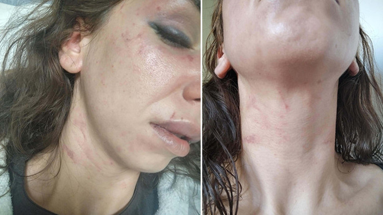 Eşine şiddet uygulayıp boğazına bıçak dayayan koca için 11,5 yıl hapis istemi