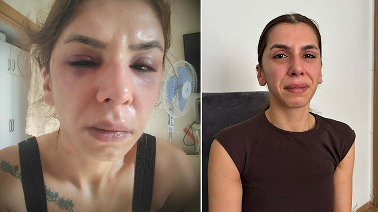 Eşine şiddet uygulayıp boğazına bıçak dayayan koca için 11,5 yıl hapis istemi